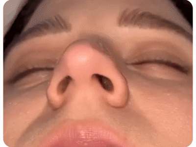 Magnetic Nasal Strips – Instantly Open Your Nose & Sleep Better